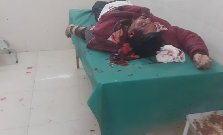 one person died in accident in dhampur syohara road
